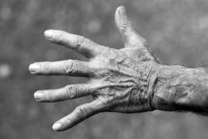 5 consigli per prevenire l’artrosi: cosa fare per rimanere sempre attivi
